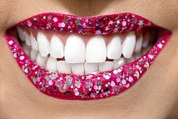 Bocas e Dentes
