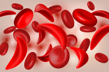 Normal red blood cell and sickle cell flow inside in artery. - 527663723