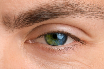 Young man with heterochromia of eye, closeup