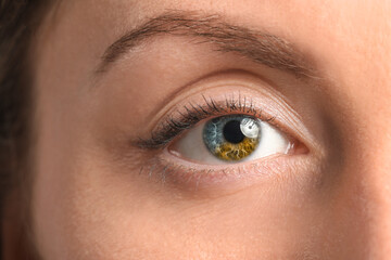 Obraz premium Young woman with heterochromia of eye, closeup