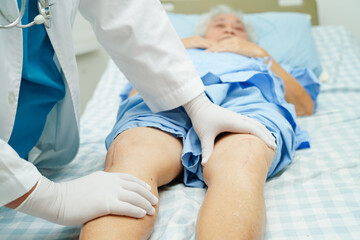 Doctor checking Asian elderly woman patient with scar knee replacement surgery in hospital.