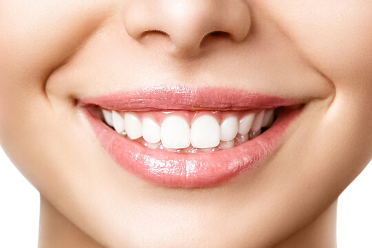 Beautiful female smile after teeth whitening procedure. Dental care. Dentistry concept