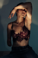Beautiful young woman with amputee arm and scars from burn on her body poses in lacy bra.