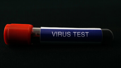 Virus test with blood sample in tube test. On black background. Concept for virus test with real blood.