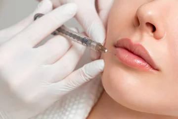 Vlies Fototapete Schönheitssalon A woman makes lip shape correction in a cosmetology clinic. Lips injections, lip augmentation.