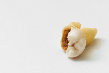 An old chipped tooth isolated on a white background.