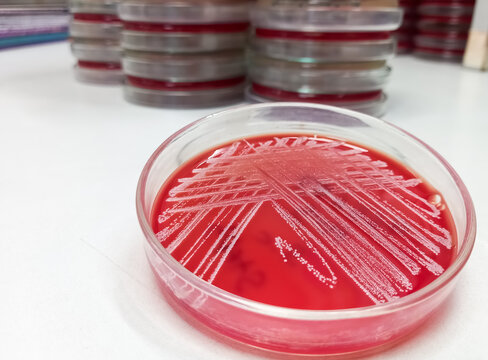 Blood agar medium growth of streptococcus, staphylococcus aureus, gram positive bacteria at medical microbiology laboratory.