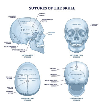 Sutures of the skull as human head bone medical division outline diagram. Labeled educational anatomical scheme with squamous, coronal, lamboid, sagittal and occipitomastoid parts vector illustration.