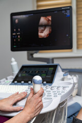 Ultrasound diagnostic equipment. Healthy scanning researchment.