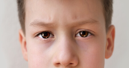 close-up of part of the child's face, boy 8-10 years old Asian-European appearance, human eye...