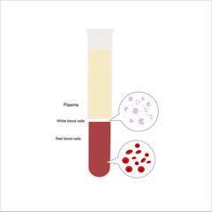 The peripheral or whole blood sample in test tube were separated in 3 layer: Plasma, white blood cells (leukocytes) and Red blood cells (Erythrocytes)