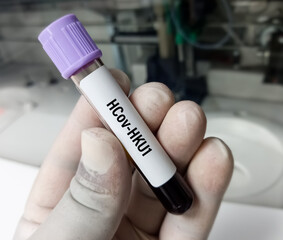 Blood sample for HCov-HKU1(Human coronavirus HKU1) test, Corona virus test.