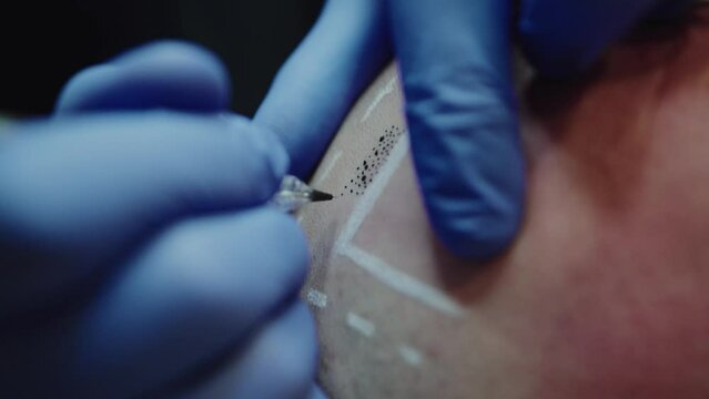 close video shot of tattoo points on a scalp