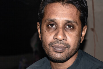 a young sick man with a dark circle on his eyes