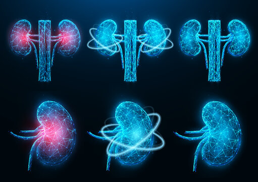 Set of polygonal vector illustrations of inflamed diseased kidney, healthy kidney, and recovery of kidney functions. Urology or nephrology medical banner, template.
