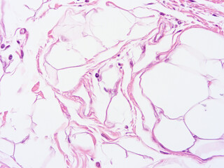 Fototapeta na wymiar Histology of human tissue, show epithelial tissue and connective tissue with microscope view from the laboratory (not Illustration Designation)