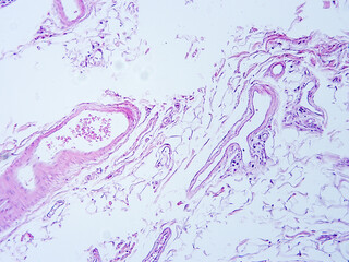 Histology of human tissue, show  epithelial tissue and connective tissue with microscope view  from the laboratory (not Illustration Designation)