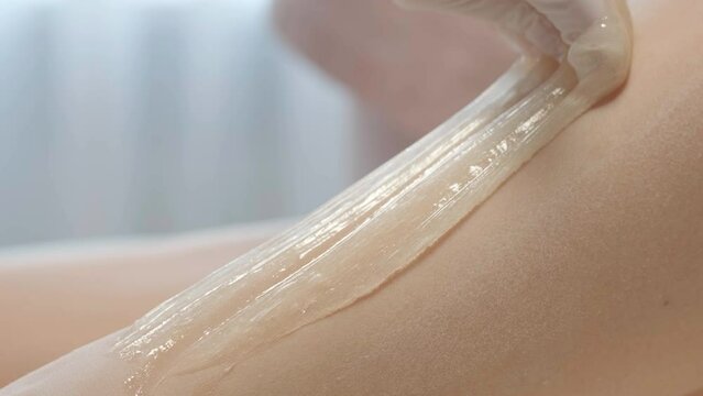 A female depilatory expert applies sugar paste on the patient's leg. The process of hair depilation on the girl's leg with sugar paste by a professional master.