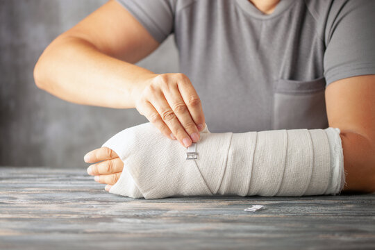 Woman with a cast on her arm wraps an elastic bandage . Girl has a broken hand wearing