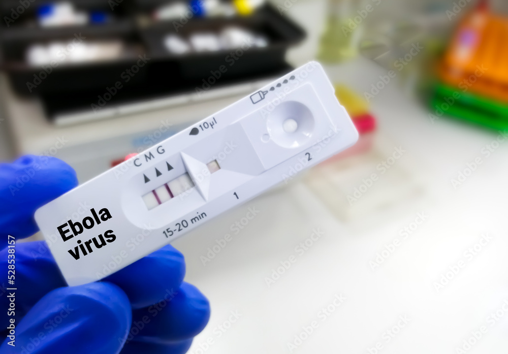 Canvas Prints Rapid test cassette for Ebola virus test.