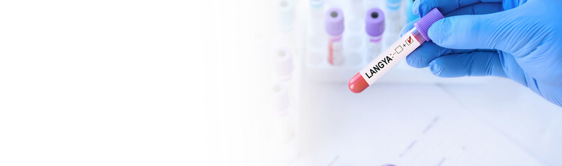 Obraz premium Doctor holding a test blood sample tube with positive Langya henipavirus (LayV) on the background of medical test tubes .The virus is transmitted from animals to humans.Banner. Copy space for text.