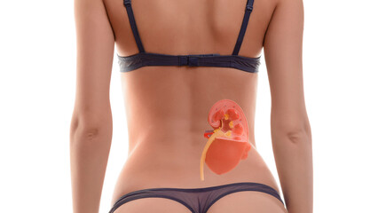 Girl in purple lingerie stands with her back with kidney hologram. Kidney disease, stones