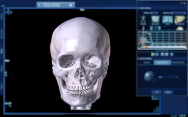 CT Scan of facial bone 3D rendering . © samunella