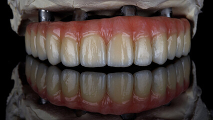 ceramic dental prosthesis of the upper jaw on the model with reflection © Dental Pro Content