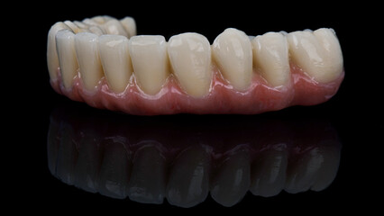 macro dental photo of a ceramic prosthesis for the lower jaw on a black background with reflection