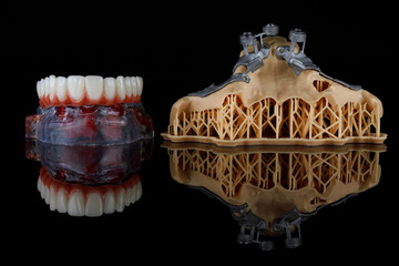 upper jaw prosthesis and model with templates for zygomatic implantation on black glass with reflection © Dental Pro Content