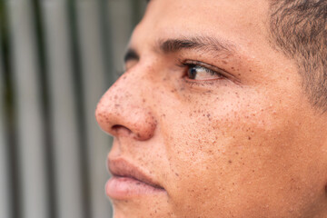 Fototapeta premium Close-up portrait of a man with freckles