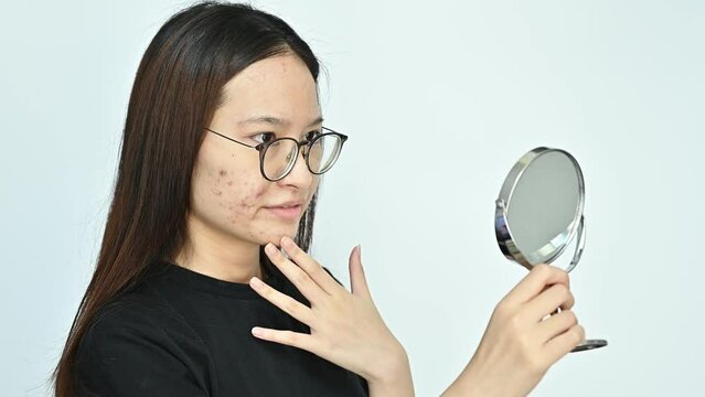 Young Asian woman worried caused of acne inflammation and acne scar occur on her face.