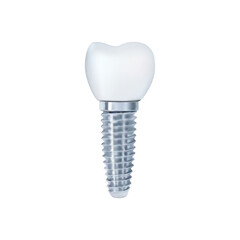 Dental implant on white background vector illustration