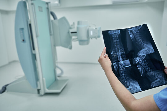 Radiologist looking at and analyzing X-ray of patient's cervical spine against background of modern radiology room at hospital