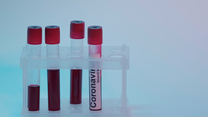 test tubes with blood sample and coronavirus lettering on blue.