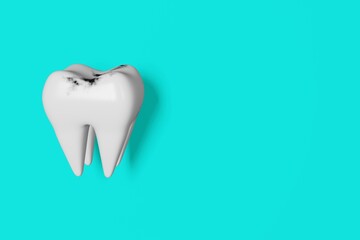 Caries tooth anatomy model 3D rendering. Sick unhealthy molar on blue background banner. Dentist Day Wisdom teeth extraction. Oral care Dental tartar hygiene plaque enamel whitening recovery Insurance