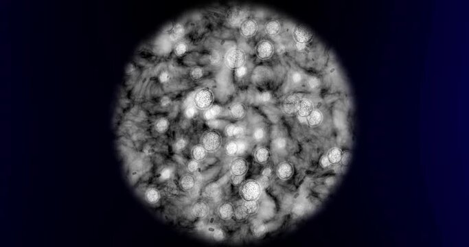 Science, cancer research and medical innovation with microscope view of bacteria or virus DNA during lab analysis study. Zoom in on microbiology experiment process, healthcare and medicine discovery