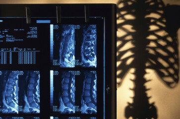 Scans of human spinal cord