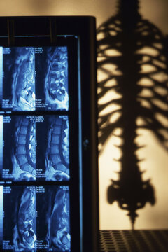 Scans of human spinal cord