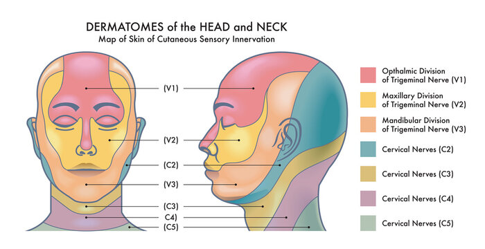 Medical diagram of Dermatomes of the head and neck.