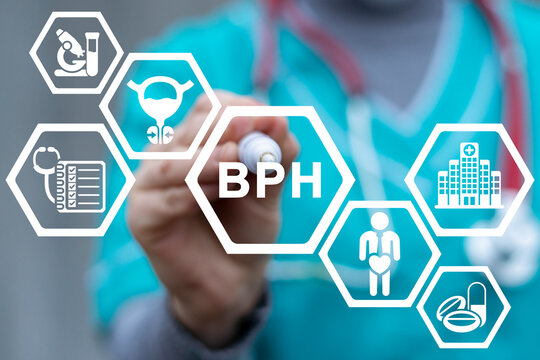 Medical concept of BPH Benign Prostatic Hyperplasia. Enlargement of prostate gland. Prostatitis test.