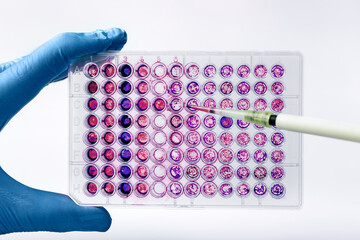 Scientist pipetting biological samples of cells into a 96-well microplate. Researcher experimenting...