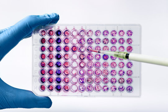 Scientist pipetting biological samples of cells into a 96-well microplate. Researcher experimenting with a diagnostic plate in wells with culture medium