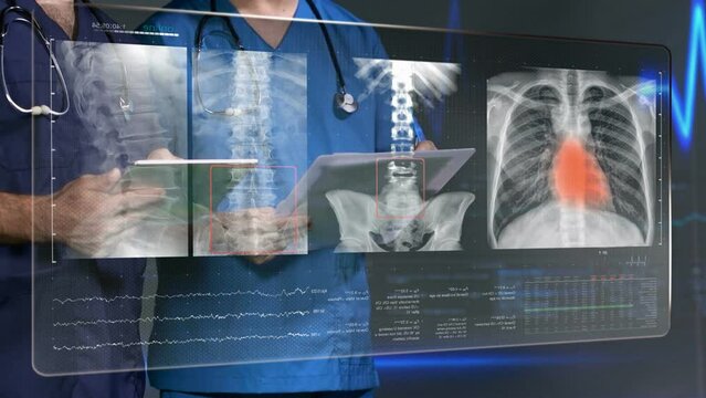 doctors looking at x ray image on monitor