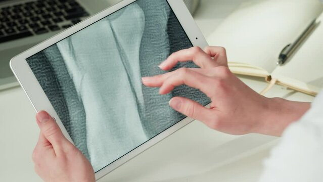 Doctor veterinarian examining horse hoof skeleton roentgen close-up. Woman vet analyzing animal bones x-ray, leg joint on gadget tablet. Healthcare and medicine concept. 