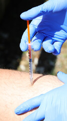 thigh and gloved hand during insulin injection due to diabetes