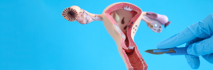 Female reproductive system anatomy uterus and scalpel closeup