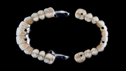 two dental prostheses on beams with ceramic crowns on a black background, top view