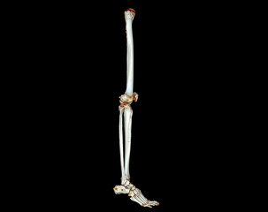 CT scan of lower extremity  3D .