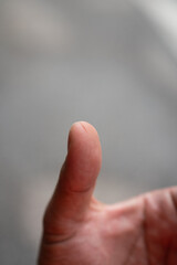 Knife cut mark on the human hand thumb finger. Healthcare and accident abstract photo, selective...